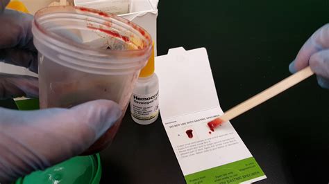 Ocvult blood lapcorl